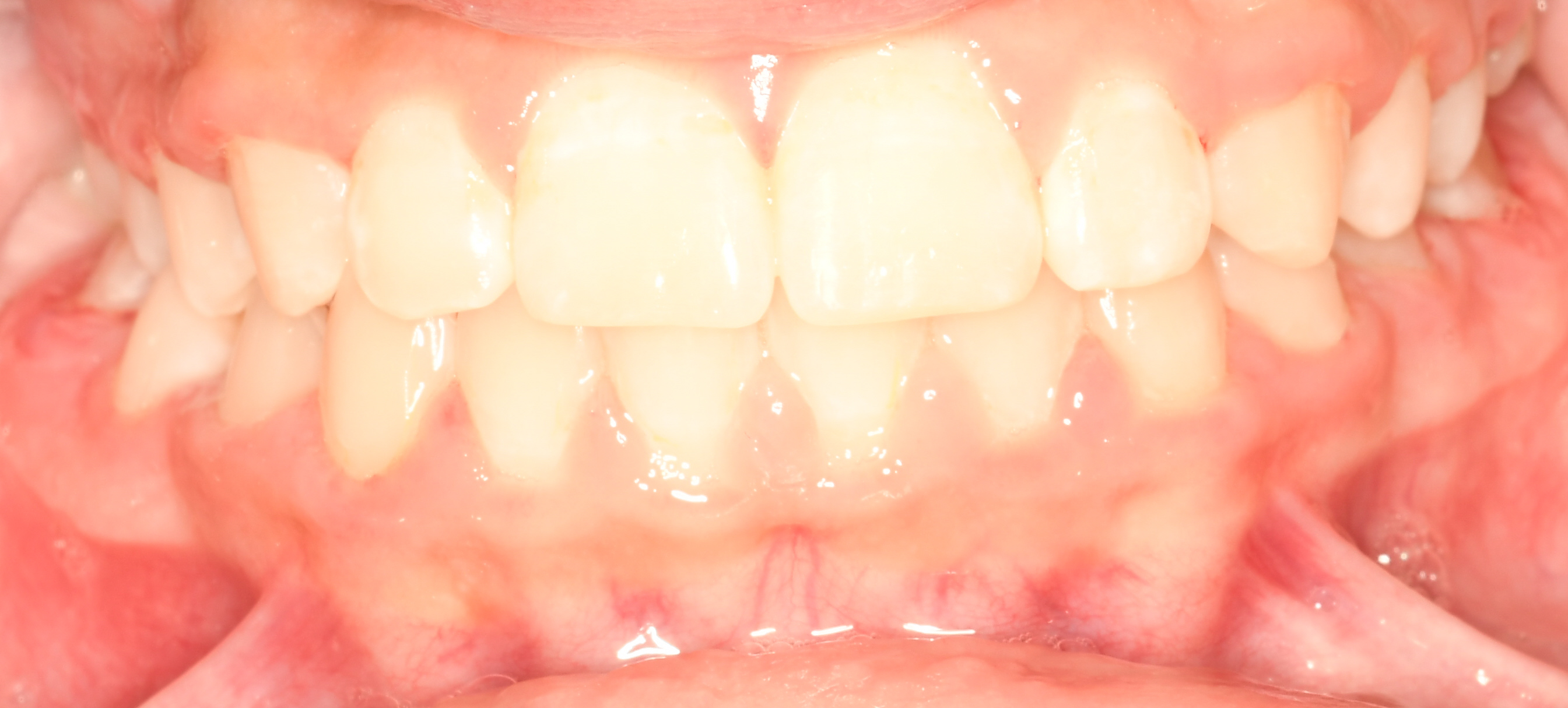 Orthodontics — after treatment